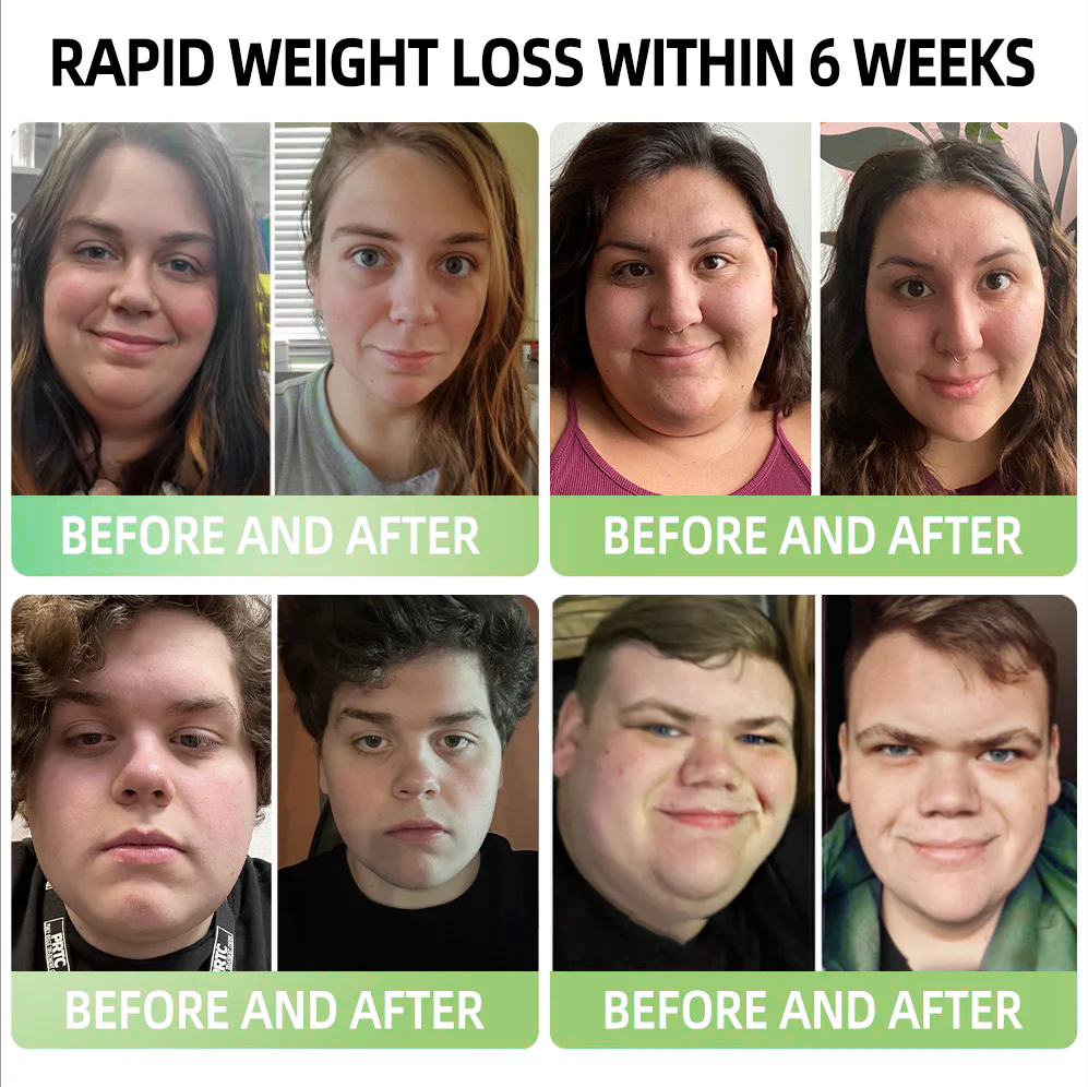 AAFQ® Meglutide（GLP-1） Slimming & Health Boost Drops🏆🏆 ( Food-grade fat burner – Developed by The Obesity Society)